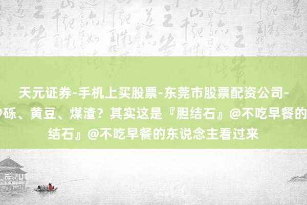 天元证券-手机上买股票-东莞市股票配资公司-配资网上开户 砂砾、黄豆、煤渣？其实这是『胆结石』@不吃早餐的东说念主看过来